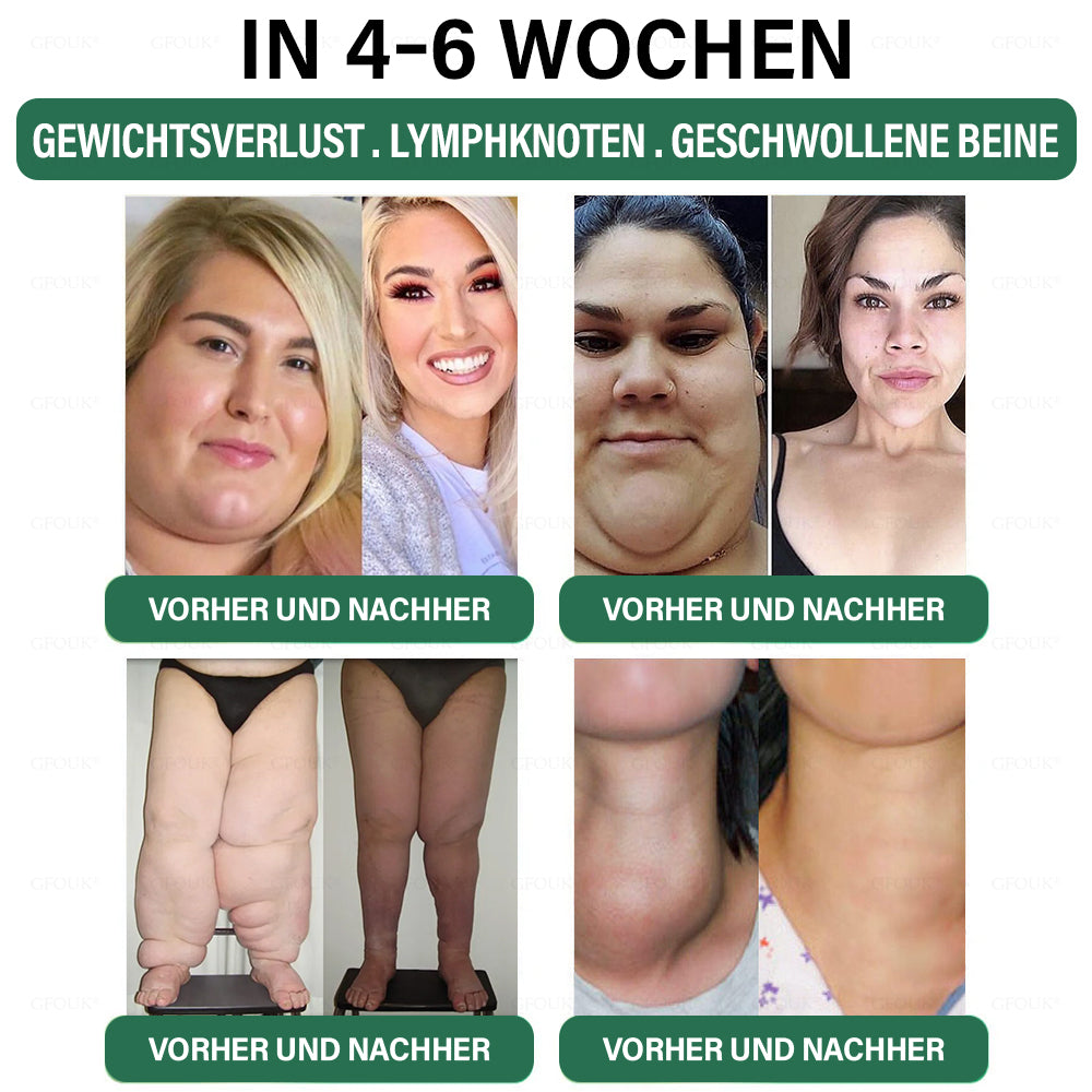 ✅ Hergestellt und versendet aus Deutschland | GFOUK® 𝐆𝐋𝐏-𝟏 Schlankheits- & Gesundheit Nasenring|⚡ Schnelles Fettverbrennen & Stoffwechselbalance